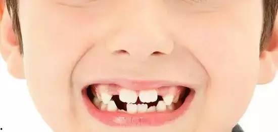 成人板牙可以换吗视频,牙齿重生之旅